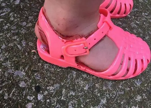 两岁女孩穿next凉鞋半小时满脚血印,家长要求品牌召回(组图)