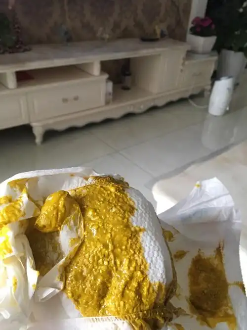 宝宝的粑粑这么多奶瓣@有图慎入