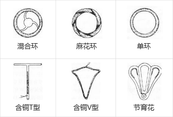 上海哪里可以上环