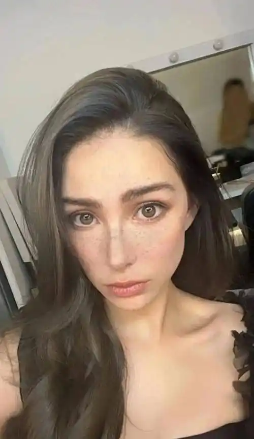 周杰伦老婆昆凌晒近照,满脸雀斑面相恐怖似"毁容",疑混血通病