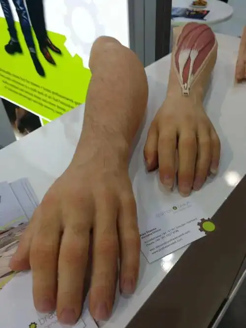 上肢假肢有哪些?该怎么选?(图2)