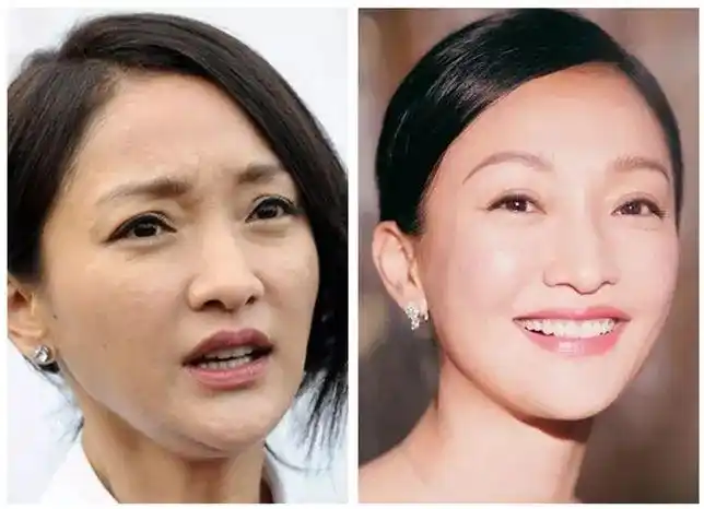 因为脸下垂最显老,而且不像斑点细纹,还能用化妆品掩盖,但松弛的脸皮