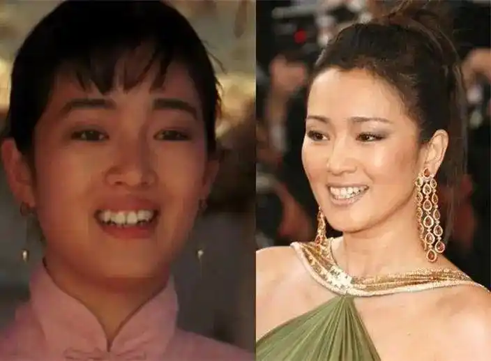 实际上,明星已经是中国最舍得花钱美白牙齿的人群,但绝大多数依然没有