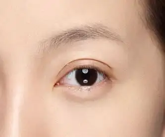 双眼皮的美感,绝非千篇一律