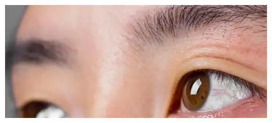 肝不好的人,身体往往有一黄二黑二臭,如果你有,需要提高警惕