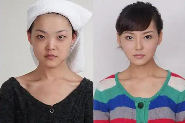 19名女子公布整容前后照片 小伙伴被惊呆了