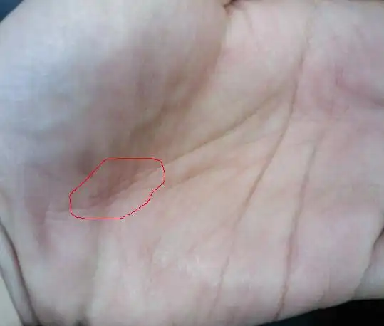 图中红色部分是岛纹吗?谢过大师