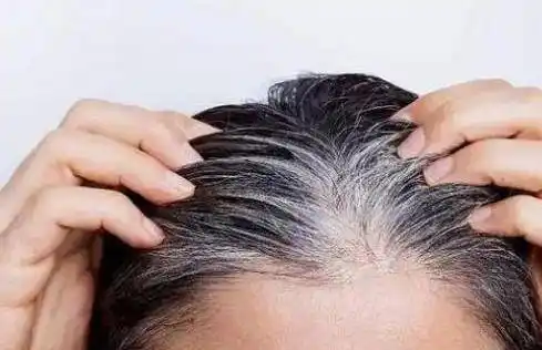 白发长在哪,病就从哪出?