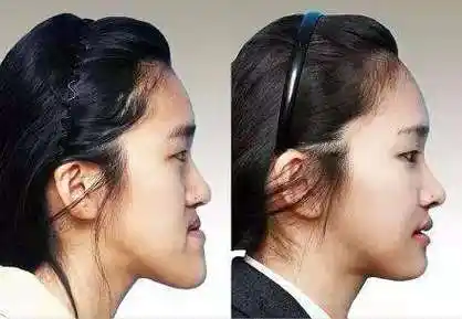 牙齿不整齐也是一种病