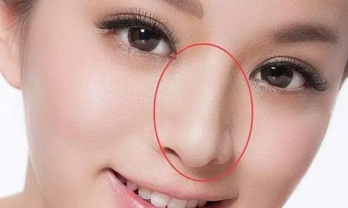 如果女人的鼻子鼻梁高而且不露骨的话天生贵气