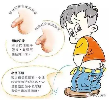 多图带你读懂什么是包皮过长