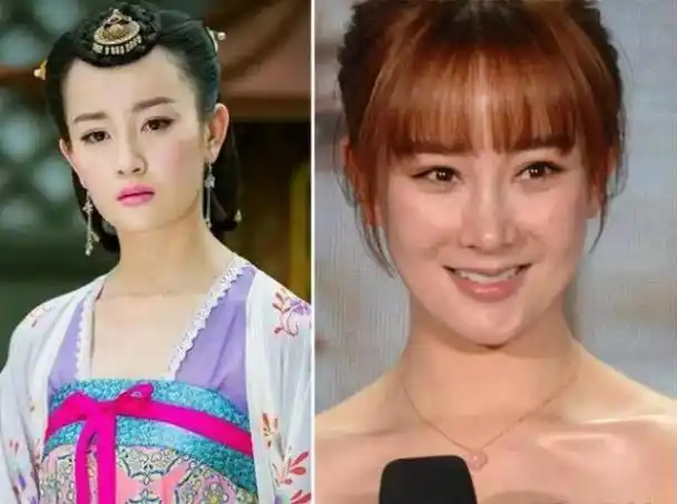 以为他们退圈了,其实是整容认不出来,明星真的要远离科技与狠活