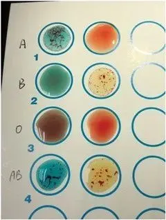 人的血型会改变吗?_细胞