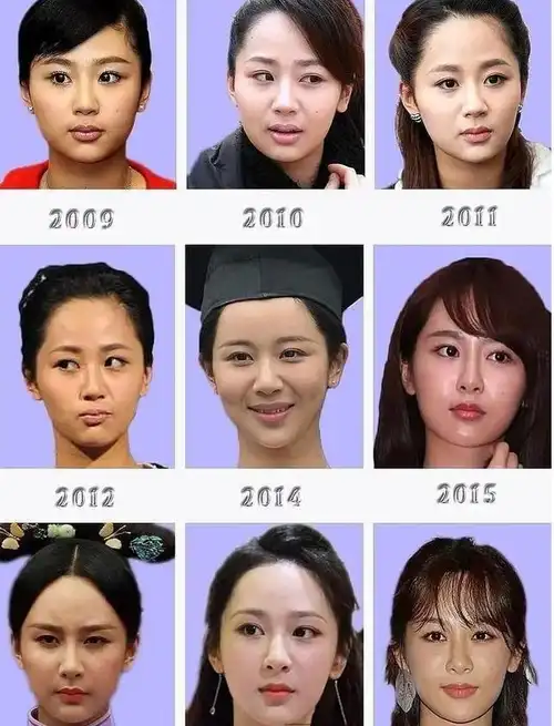 杨紫"变脸"又陷整容质疑,网友晒照称下巴尖到能锄地,做表情都难_网易