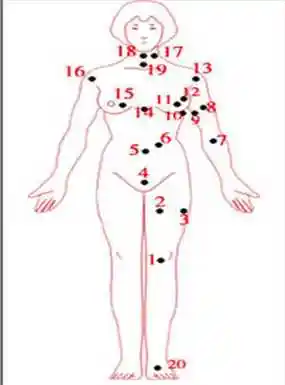 女人全身痣相图解好坏夹杂需要注意