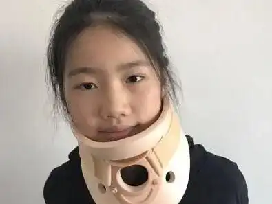 及时治疗落枕,纠正不良的工作姿势,不要过度低头,歪脖子太久,而且要