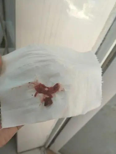 阴道有点出血丝,医生检查后立即建议我卧床休息保胎,是先兆流产的表现