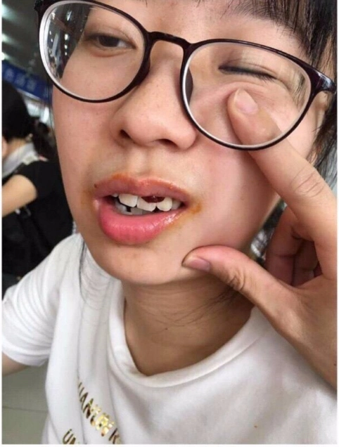 互动问答| 你照过最丑的一张照片是什么?