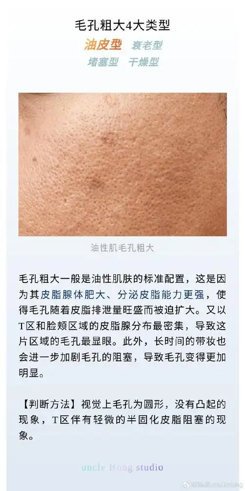 美丽觉醒计划##好肌肤养成记##毛孔粗大如何改善