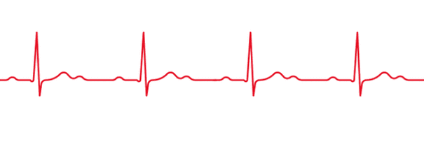 起心跳60次/分钟的人,90次/分钟的人20年里会多跳3亿下,心脏负荷更大