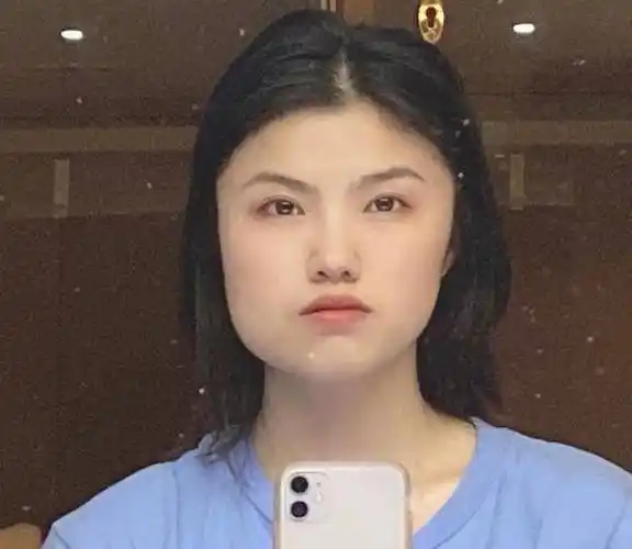 怎么测试自己脸大不大怎么判断自己脸大是什么原因