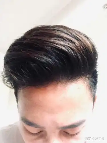 只是这种发型比较吃头型,后脑勺比较平的留这个不好看 蛮喜欢的,学校