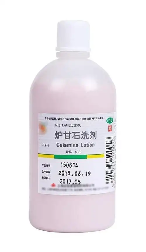 宝宝得痱子湿疹荨麻疹怎么办