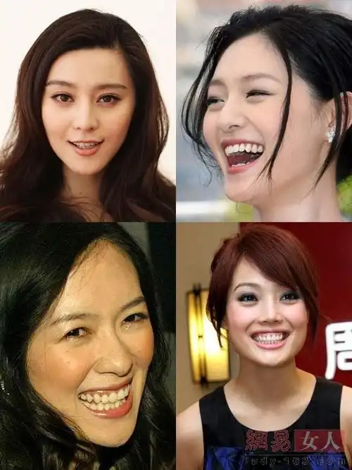 牙齿全露会怎样?各位看看吧.就算是颜值超高的范爷也难逃一劫.