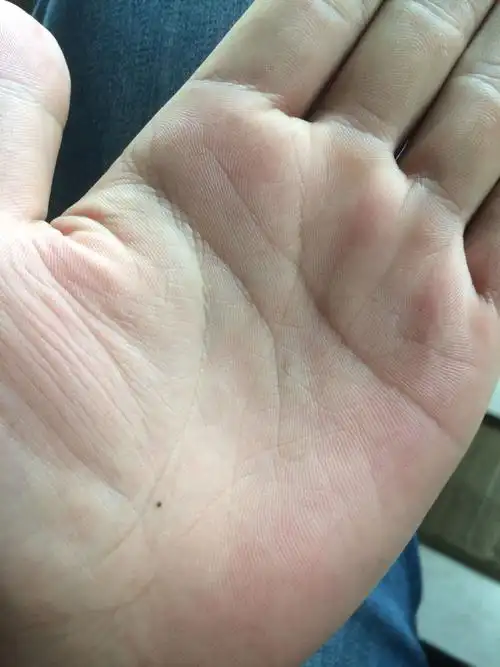 掌心痣. 有什么说法么? 可以帮忙看看这个痣有什么讲究吗?
