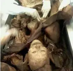 重庆医科大现"玩尸女" 大学生素质遭质疑/图