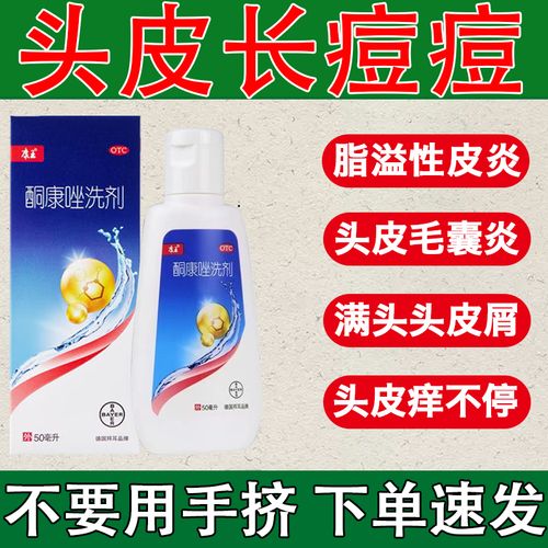 康王 酮康唑洗剂 50ml 脂溢性皮炎脱发 毛囊炎专用洗发水 头皮瘙痒