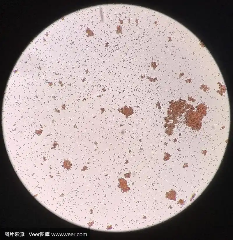 交叉配血试验中的红细胞凝集.用手机拍照.