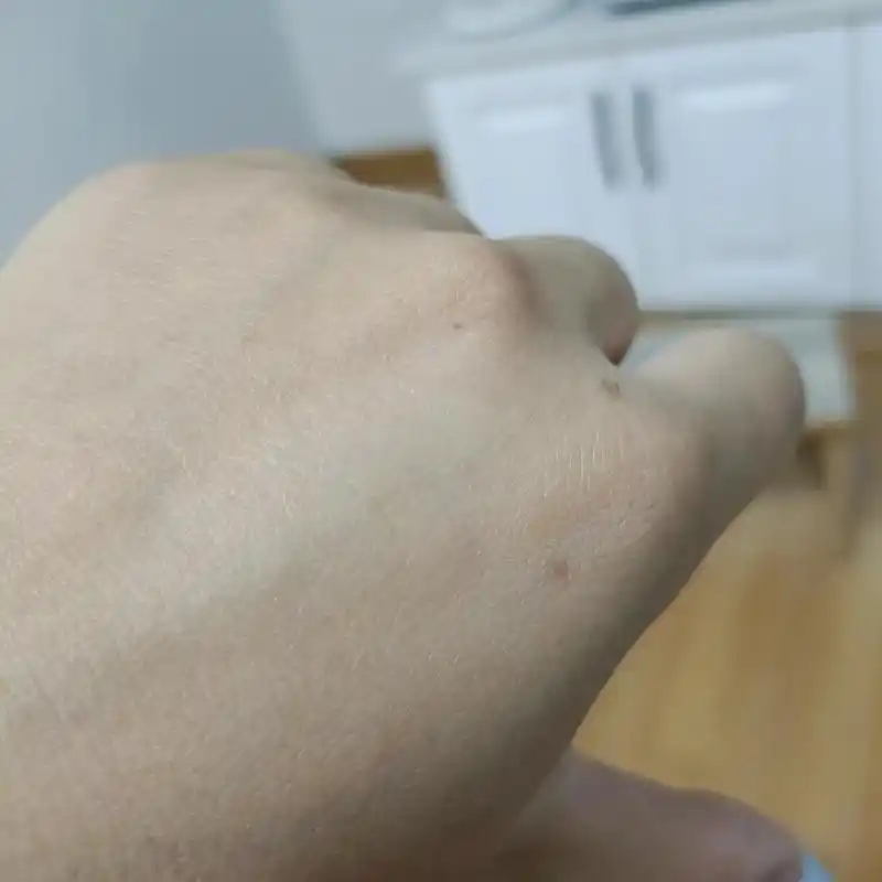 左手突然长了一颗痣,"曾听人说,左手长痣,代表在爱里被辜负的 - 抖音