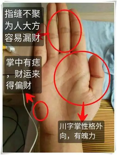 对于很多朋友生命线,如果比较杂乱,岛子纹路多,代表健康方面需要预防
