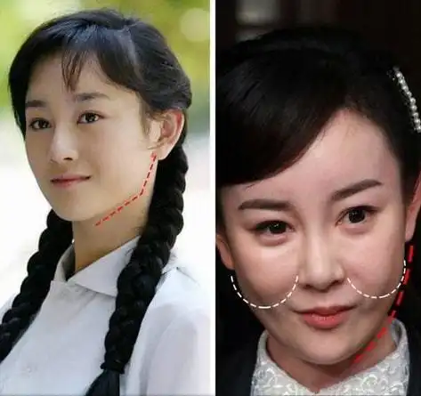 5位整容明星有的事业全毁靠直播卖货生存有的却被网友叫好