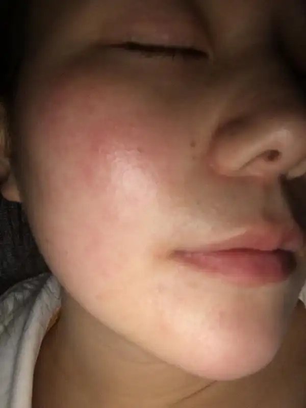 才换了一款护肤品用在脸上很刺痛 很痒 但是家里猫咪也刚来家里 就很