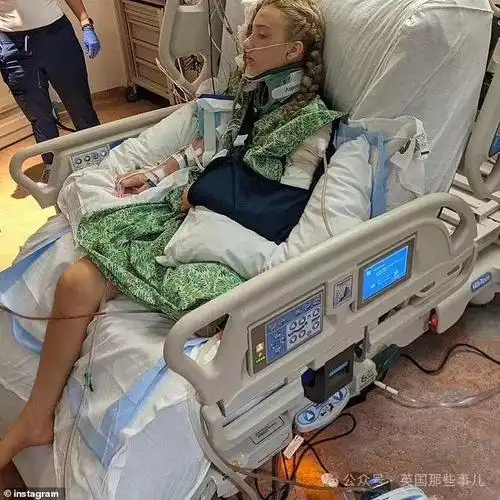 开心|截肢|安全带|kennedy|dailymail_网易订阅