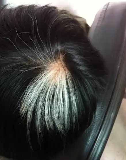 你开始长白头发了吗有了丰秘逸发液再也不用怕