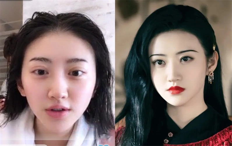 取假体,紧致皮肤,修复双眼皮,明星整容失败想要回春得多努力?