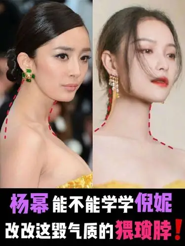 作为一线女明星,为什么明知道自己脖子前倾却不去改善呢?