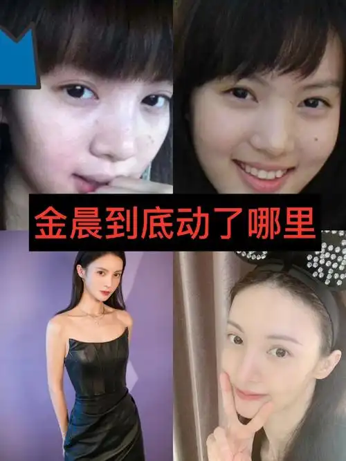 金晨刚出道时的#鼻骨#较宽,所以虽然侧面轮廓还不错,但是正面鼻梁显得