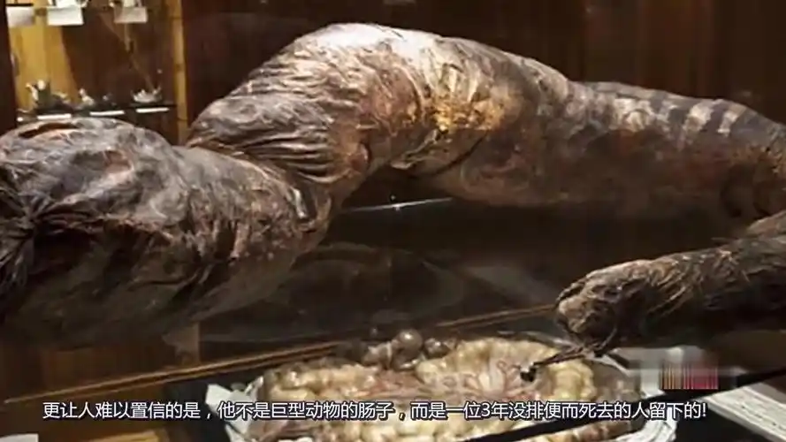 世界上不大便时间最长的人,3年不大便,肚子装有接近三十斤大便