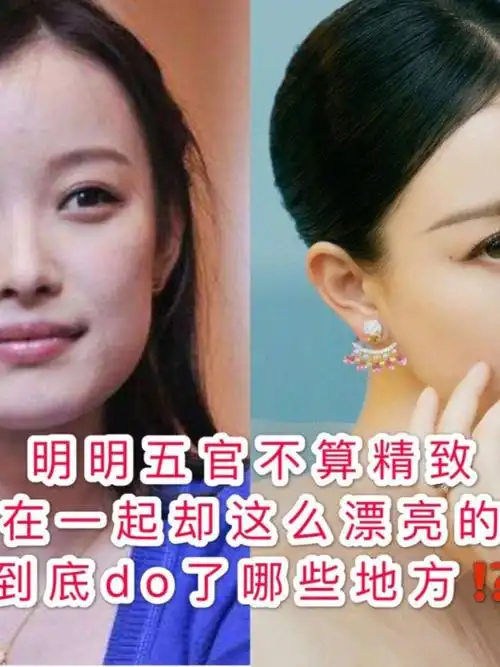 明明五官不算精致,组合在一起却这么漂亮的倪妮,到底动了哪些地方