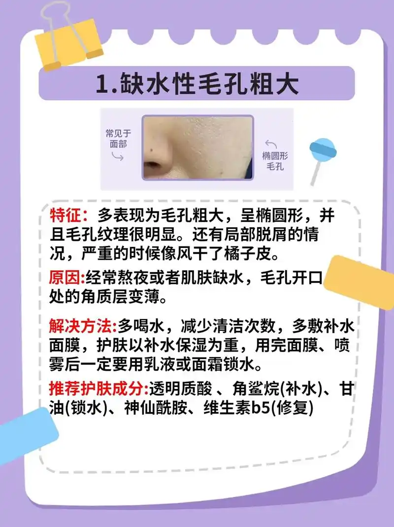 分清毛孔粗大类型,针对改善.毛孔粗大是很多女神 - 抖音