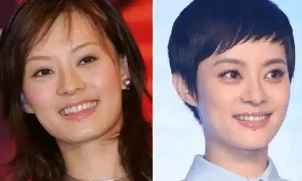 何况整牙有时候对一个人颜值的影响也很大,圈子里整牙的女星很多,孙俪