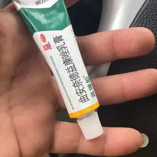 派瑞松曲安奈德益康唑乳膏15g1支皮炎湿疹手足癣真菌感染甲沟炎软膏