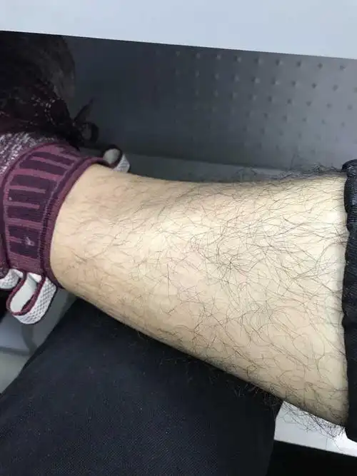 我腿毛特别浓密如图