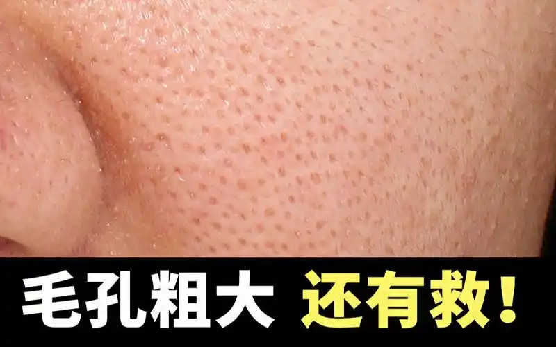 皮肤学博士说:毛孔粗大?还可以抢救一下!