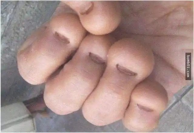 孩子爱咬指甲,妈妈要注意了!