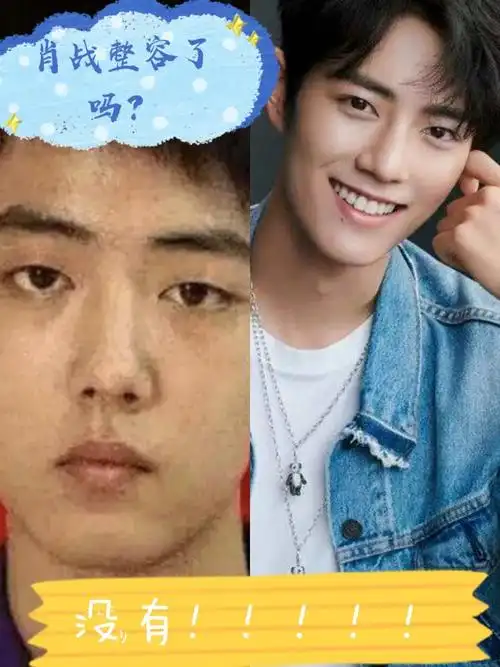 hello大家好,这里是小羊9796肖战早期素人照片跟_圈子-新氧美容